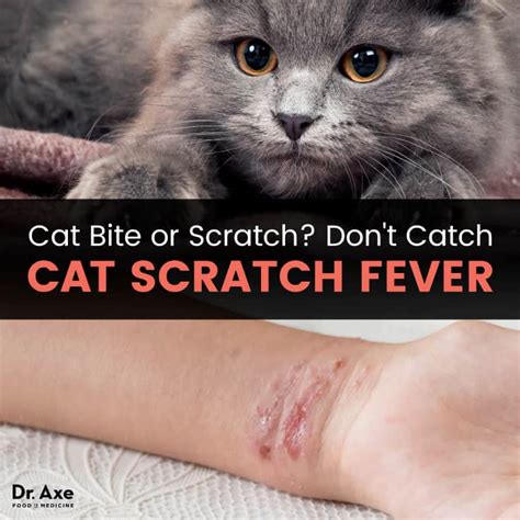 how to play catch scratch fever